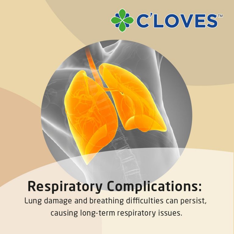Long Term Effect Of Covid 19: Respiratory Complications